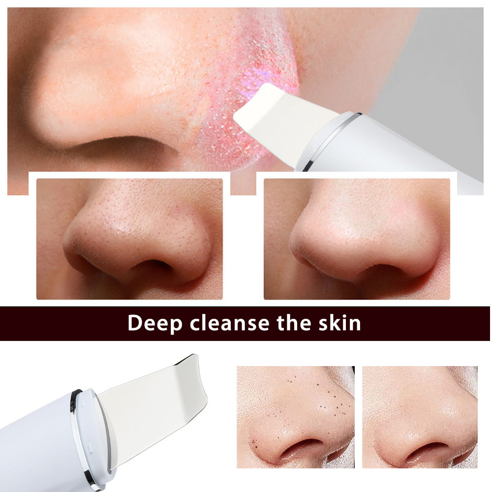 Velveta™ Ultrasonic Pore Cleaner – 4-in-1 Deep Cleansing Tool