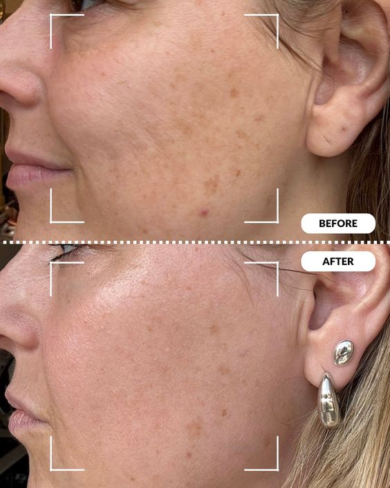 Velveta RadianceC™ – Vitamin C Facial Mask
