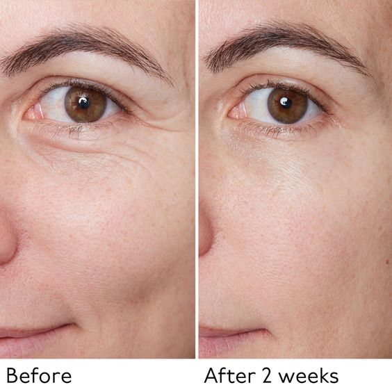 Velveta™ HydraGlow – Hyaluronic Acid Facial Mask