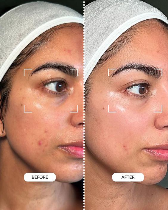 Velveta RadianceC™ – Vitamin C Facial Mask