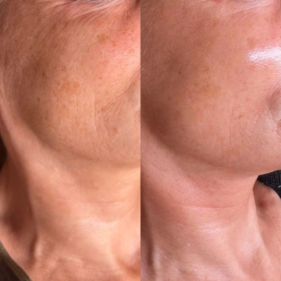 Velveta CollagenLift™ – Anti-Aging Collagen Facial Mask
