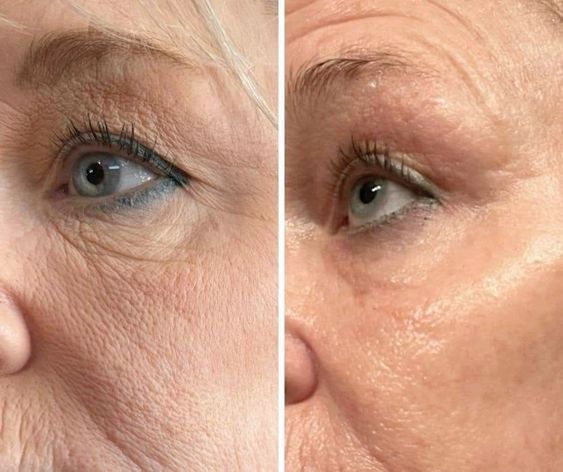 Velveta CollagenLift™ – Anti-Aging Collagen Facial Mask